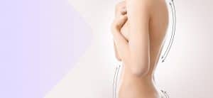 Plasztikai sebészet