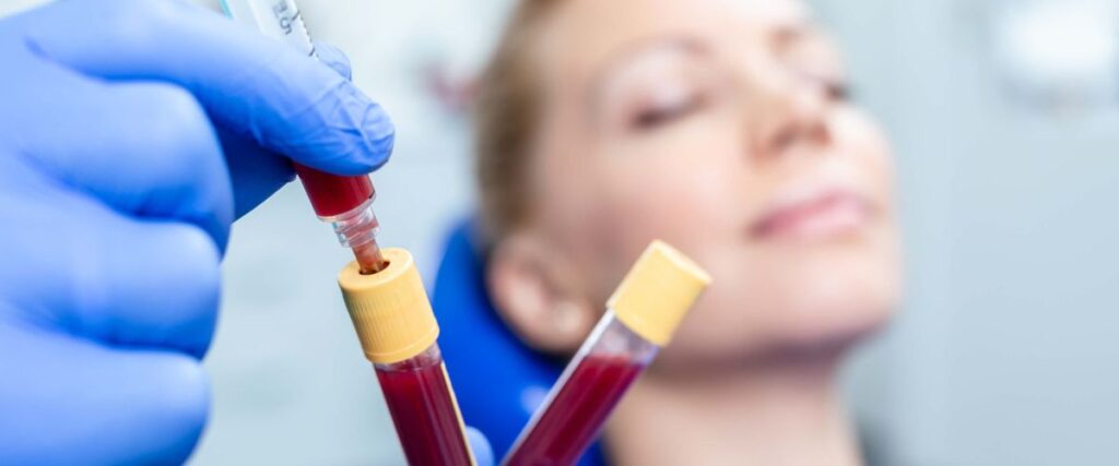 PRP kezelés PRP kezelés