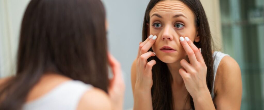 Szem alatti karikák eltűntetése