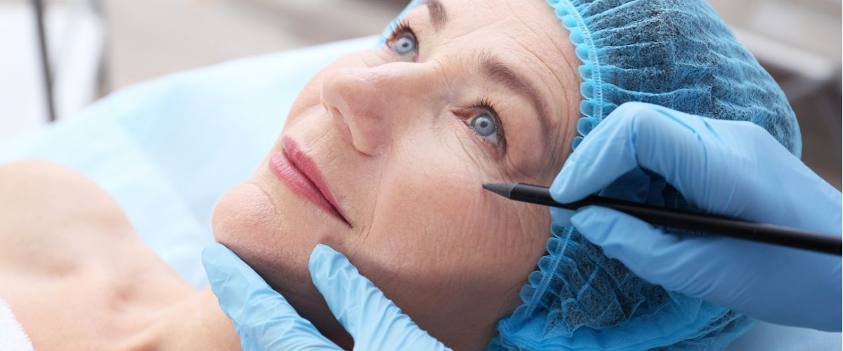 hyaluronsavas ráncfeltöltés 1