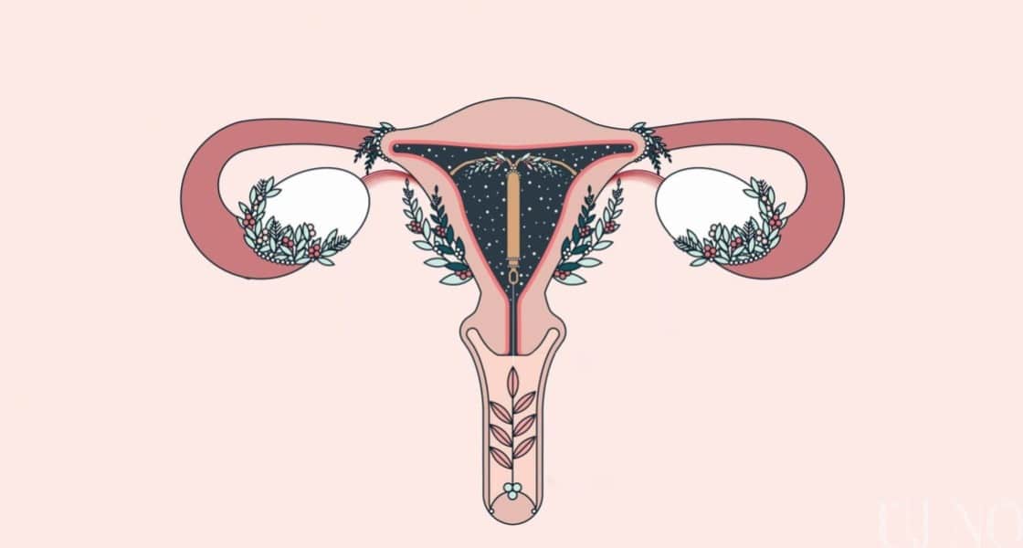 Endometriózis