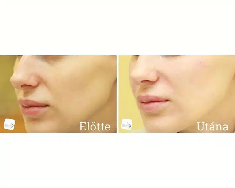 Állív formázás Előtte Utána