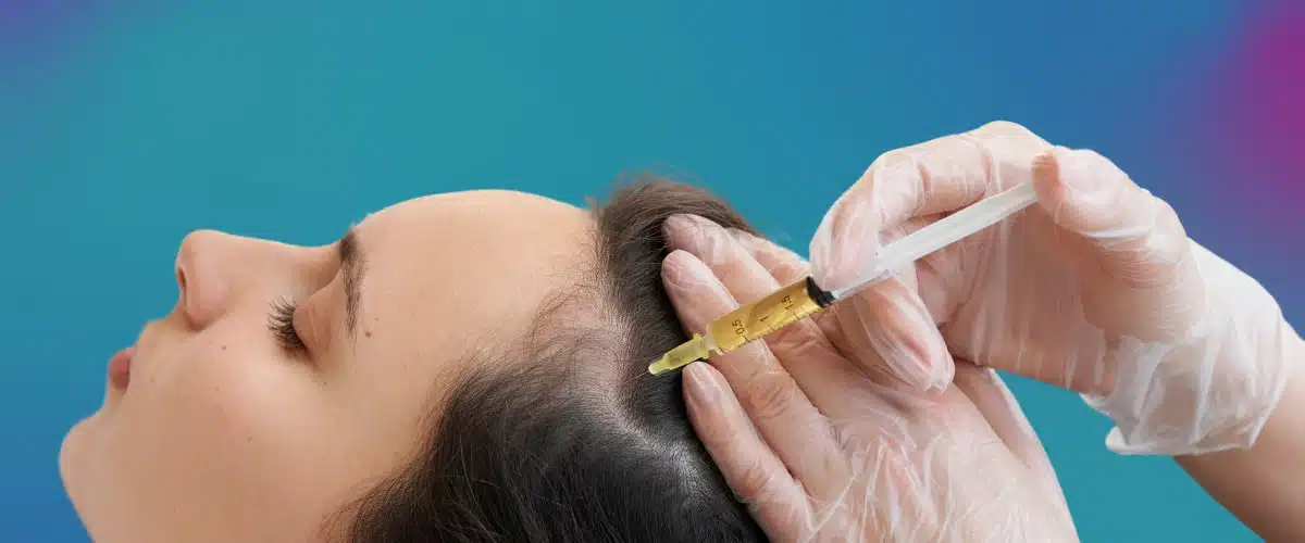 Exosome hajterápia