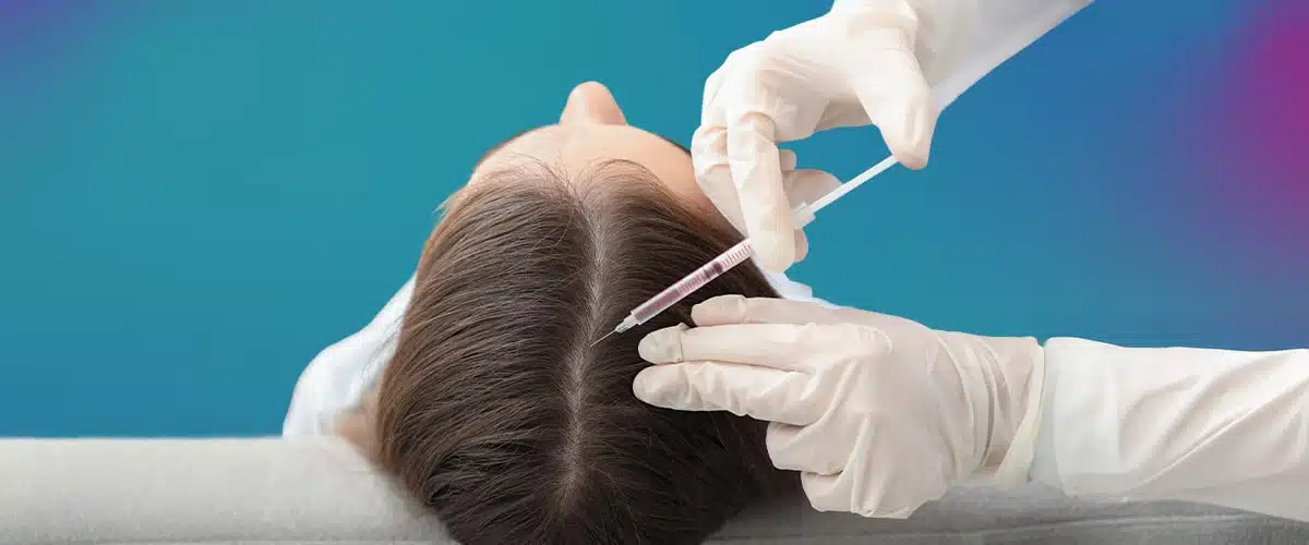 Hajmezoterápiás kezelés