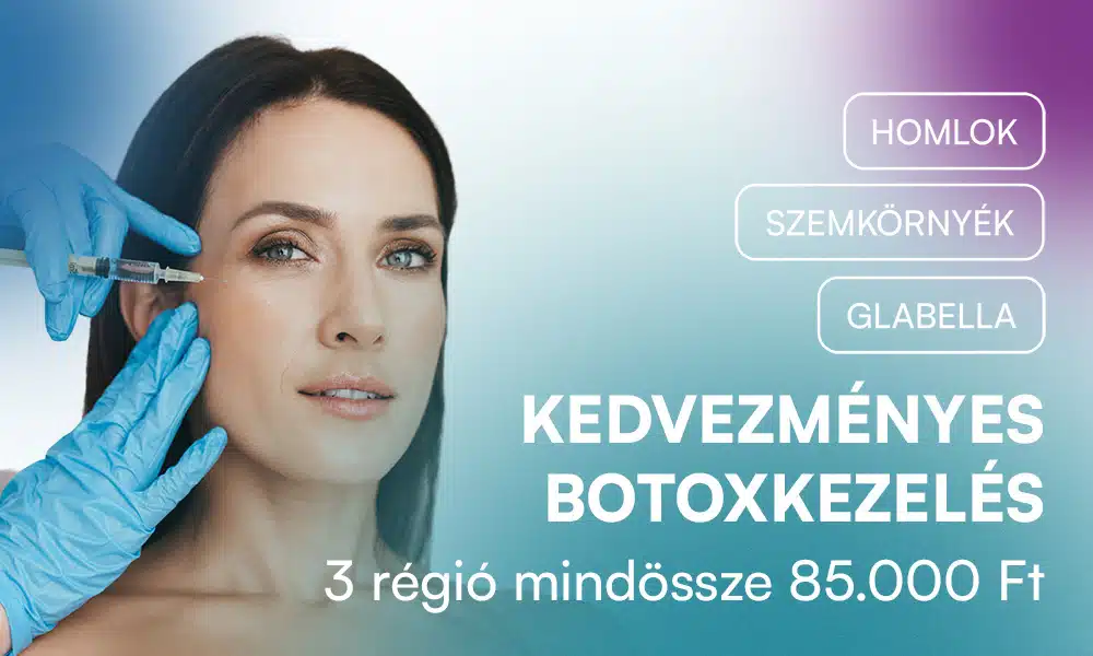 Botox3regio 1000x600